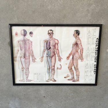 Acupuncture Print