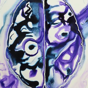 Tangled Thoughts  -  original ink painting on yupo - neuroscience art 