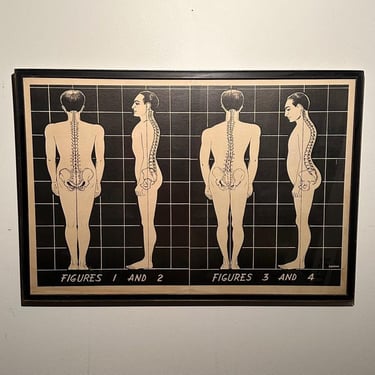 1930s Medical Spine Lithograph Poster with Black Grid Background - Unusual Chiropractic Posters - Rare Clinical Decor - One of a Kind 