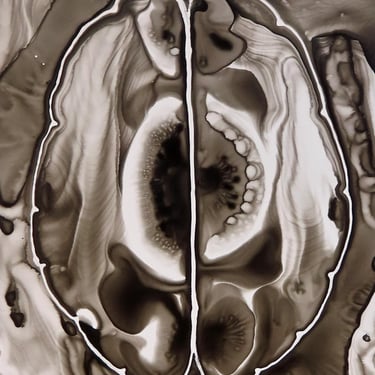 Black Ink Brain  -  original ink painting on yupo - neuroscience 