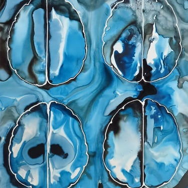 Brain Scan in Blue and Black - Neuroscience Art 