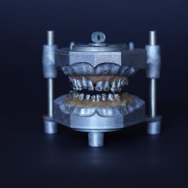 1940's Orthodontic Teeth Set on Articulator Stand
