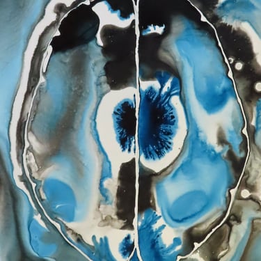 Flash of Insight Brain  -  original ink painting on yupo - neuroscience art 