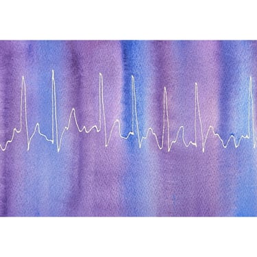 Purple and Blue Atrial Fibrillation - original watercolor ekg painting- A-fib 