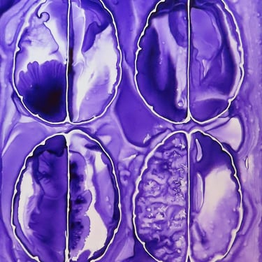 Purple Brain Scan - Original Ink Painting on Yupo - Neuroscience Art 
