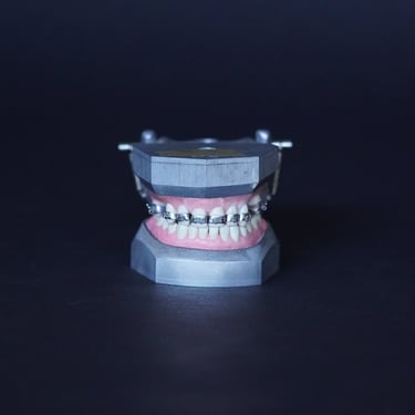 1940's Orthodontic Teeth Set