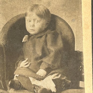 Victorian Curiosity Photo Antique Black And White Photograph Deformation Child Boy Oddities 