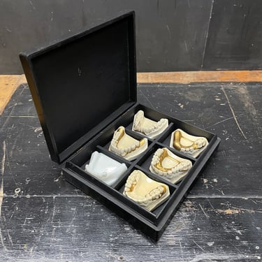 Antique Dental Teeth + Gold Bridge Models Plaster, Milk Glass Vintage Dentistry Uppers Lowers Teaching 